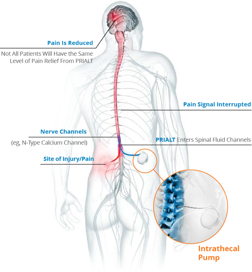 avatar nerves graphic